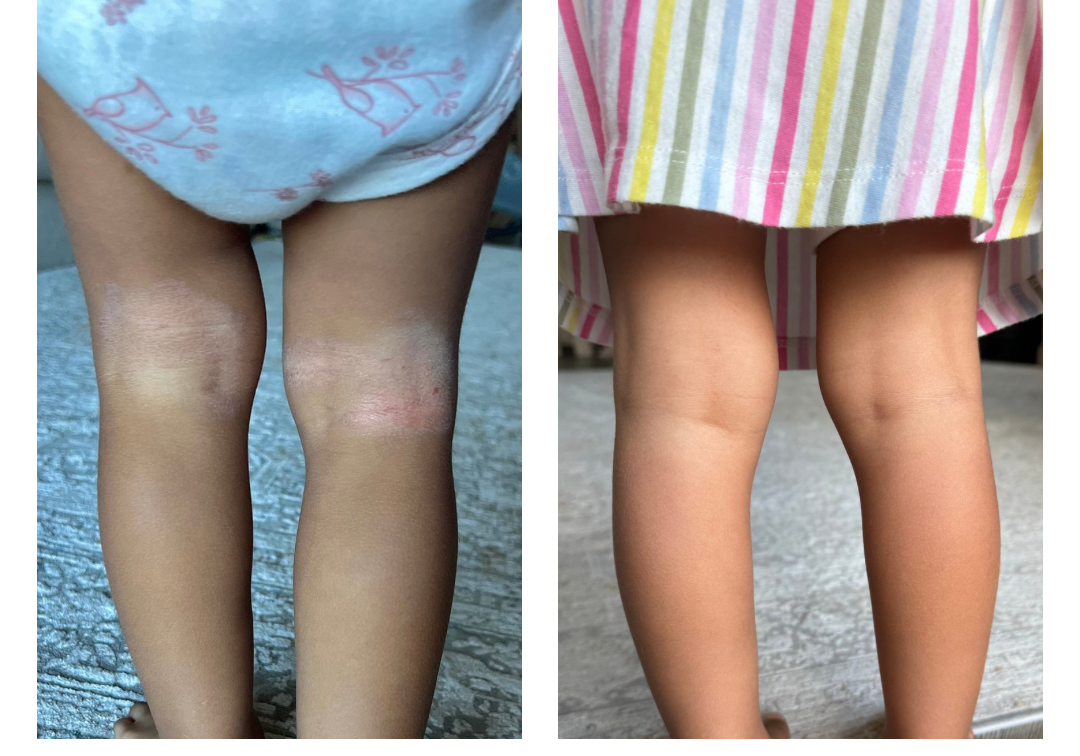 Healing You Can See: Our Tallow Story in Pictures