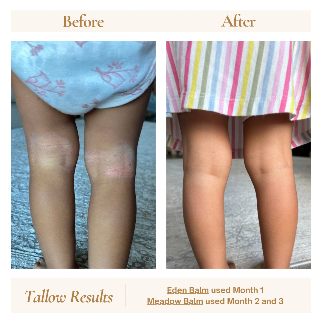Healing You Can See: Our Tallow Story in Pictures